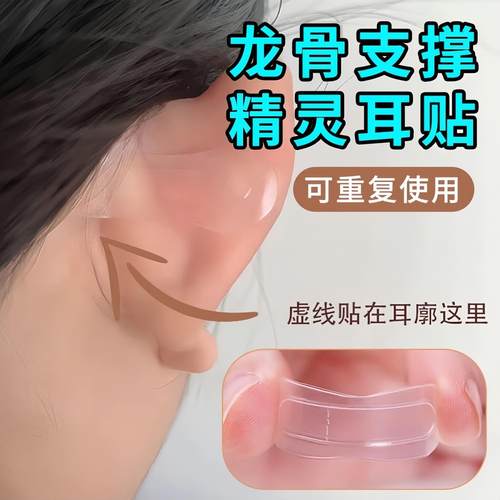 精灵耳贴定型贴支撑力贴面耳防水矫正器隐形新款立耳贴女生显脸小