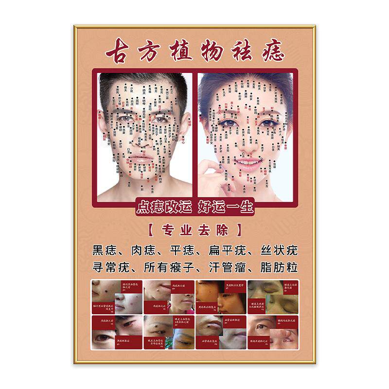 男女点痣宣传图面部点痣图点疣祛斑祛痣海报取痣广告图起痣痦子图