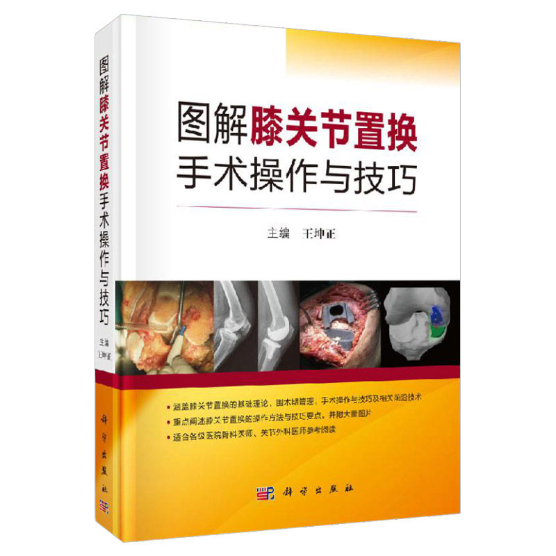 图解膝关节置换手术操作与技巧 微创技术 导航技术 3D打印技术及机器人在人工膝关节置换中的应用 坤正主编 9787030616418
