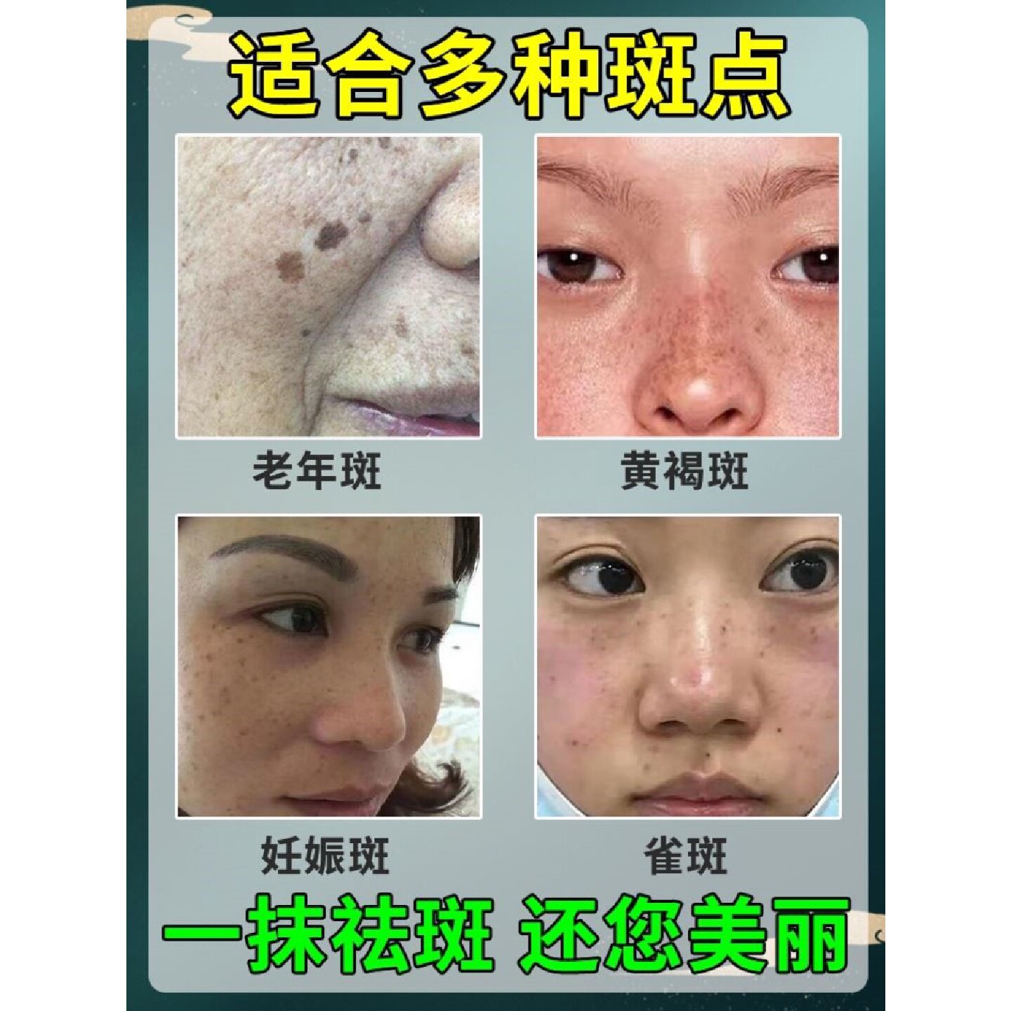 议价去老年斑强力去除黑色素手部脸部专用霜去黄褐斑正品药膏