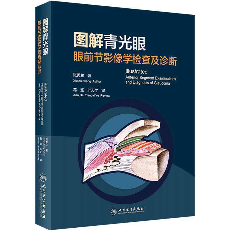 图解青光眼 眼前节影像学检查及诊断张秀兰眼科疾病临床案例诊治教程眼科学房角镜oct裂隙灯显微镜玻璃体角膜屈光视网膜病变工具书