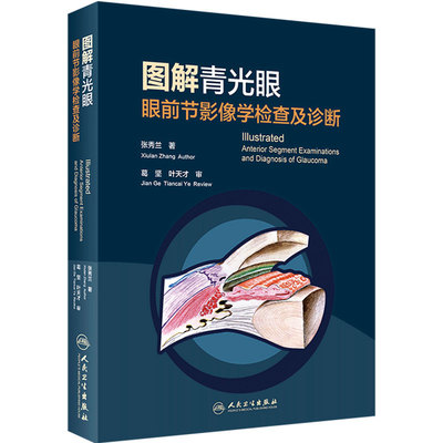 图解青光眼 眼前节影像学检查及诊断张秀兰眼科疾病临床案例诊治教程眼科学房角镜oct裂隙灯显微镜玻璃体角膜屈光视网膜病变工具书