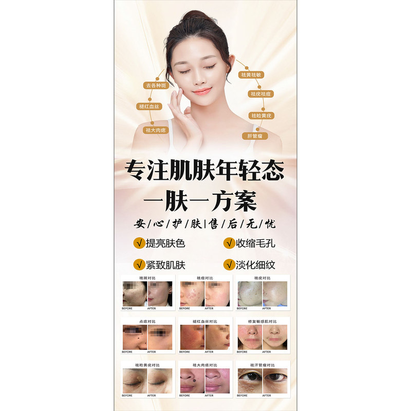 祛斑祛痘展架斑敏痘宣传海报点痣