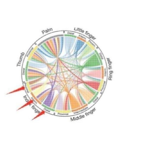 生信分析TCGA-GEO数据库挖掘1-10分单细胞测序生信分析服务