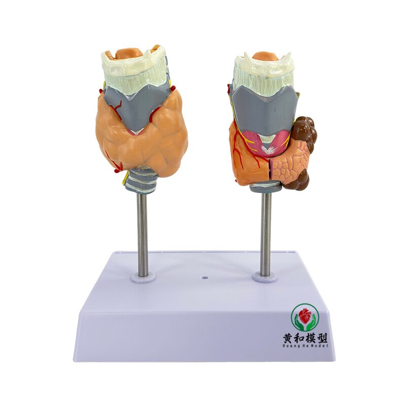 黄和模型甲状腺病变模型