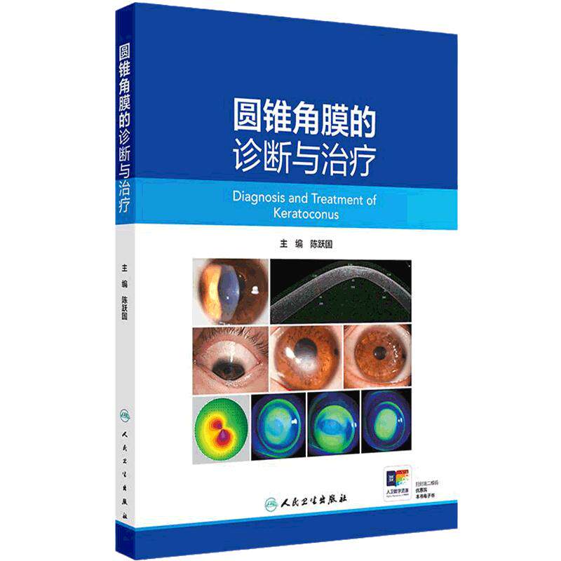 圆锥角膜的诊断与治疗 陈跃国 主编 圆锥角膜的流行病学 角膜地形图特征 供眼科医生及医学生阅读参考9787117371681人民卫生出版社