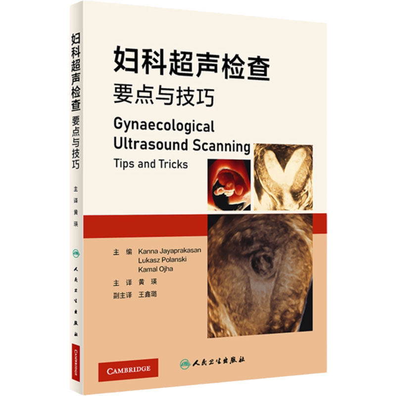 妇科超声检查要点与技巧 黄瑛主译 妇科超声先进技术超声设备报告书写 超声扫查技术疾病诊断 影像学 人民卫生出版社9787117347372