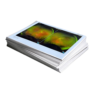 医用相片纸A5相纸眼科专用拍片报告单眼底照片医院四维彩超打印纸