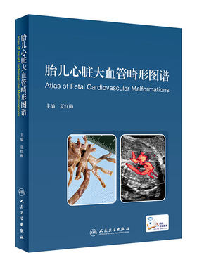 胎儿心脏大血管畸形图谱 胎儿心脏畸形超声诊断 心血管外科学 夏红梅 9787117297097 人民卫生出版社