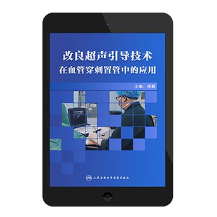 改良超声引导技术在血管穿刺置管中的应用基础版徐颖人卫音像