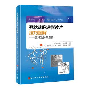 当当网冠状动脉造影读片技巧图解 正常及异常造影 教你从冠脉造影小白 快速进阶PCI达人 北京科学技术出版社书籍