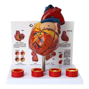 人体心脏血管解剖结构模型彩超可拆卸三维立体自然大医学教学模具