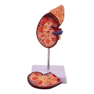 人体肾脏模型 肾解剖附肾上腺放大模型病变肾脏 人体内脏器官解剖