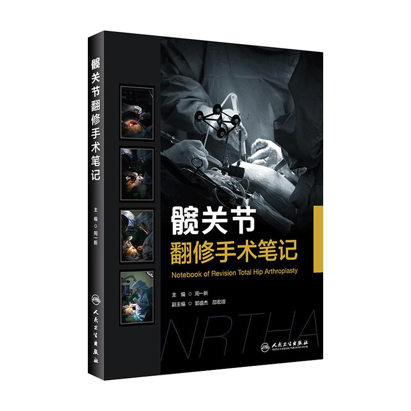 预售髋关节翻修手术笔记