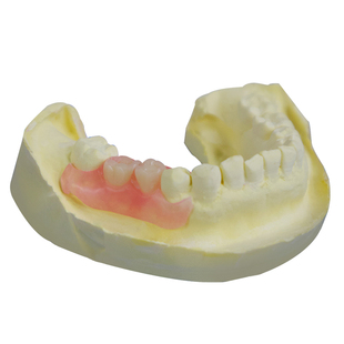 活动义齿定制假牙超硬塑钢牙可卸下定制义齿隐形假牙仿真牙科同款