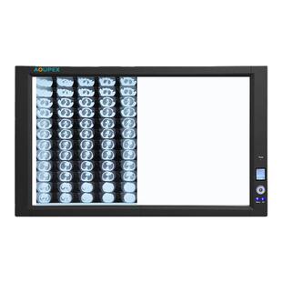 双联LED专业医用观片灯口腔牙科骨科看片灯X光CT核磁超薄阅片灯箱