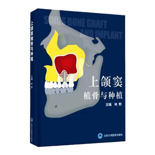 正版现货 上颌窦植骨种植 基础理念和临床技巧 口腔种植学 牙手术学图解美学区域修复精准植入技巧数字化实用技术精要现代牙科牙体