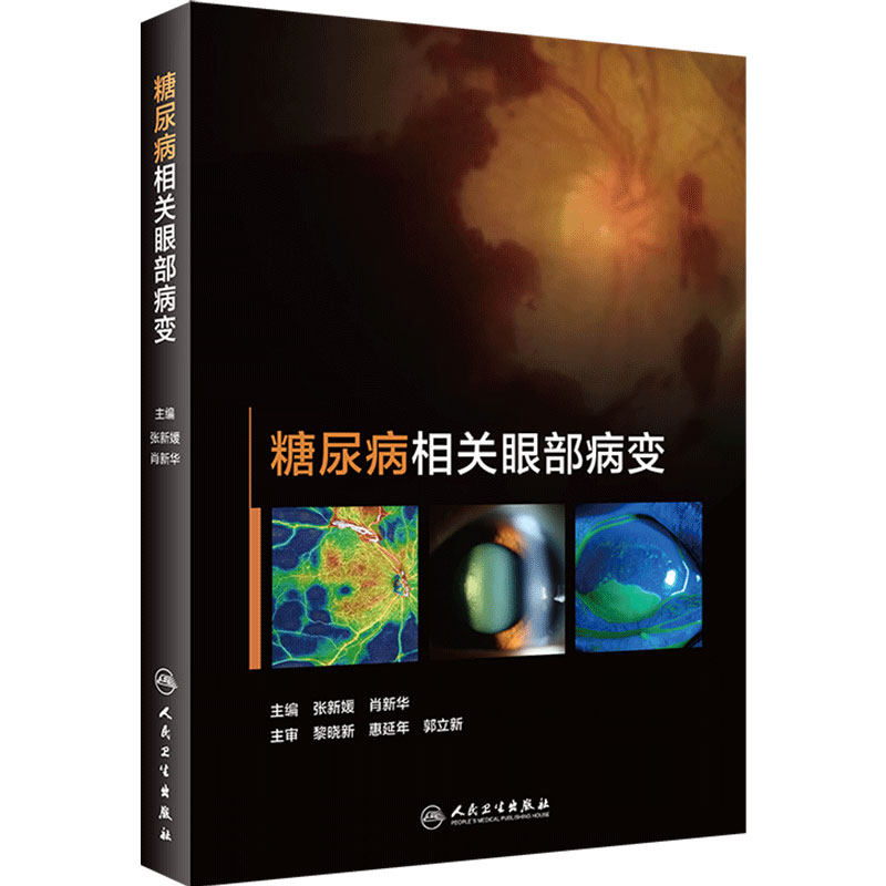 糖尿病相关眼部病变 眼毛细血管视网膜病变黄斑水肿眼表肌白内障眼底病视光视力恢复角膜青光眼人民卫生出版社实用手术眼科书籍