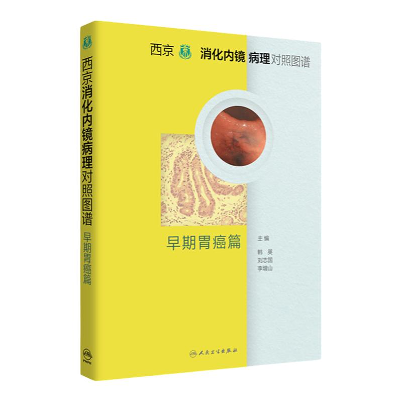 西京消化内镜病理对照图谱早期胃癌篇贲门胃窦胃小大弯幽门癌症病