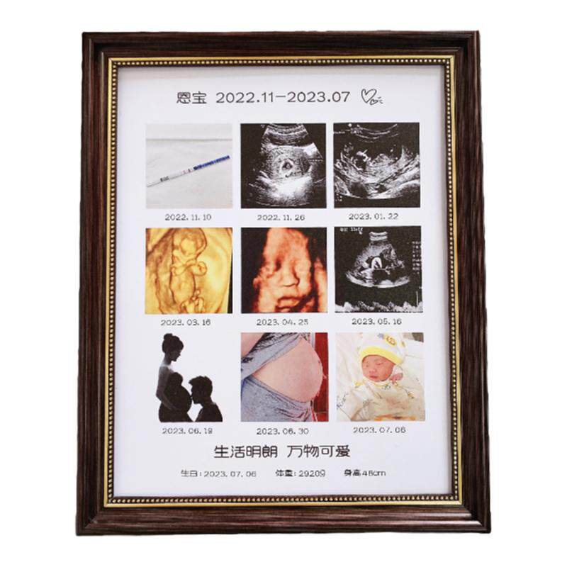 孕期b超相框定制宝宝四维彩超产检照片打印婴儿满月周岁礼物纪念