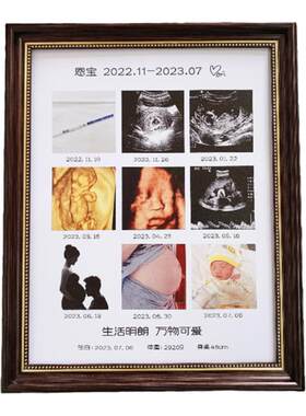 孕期四维b超纪念相框定制