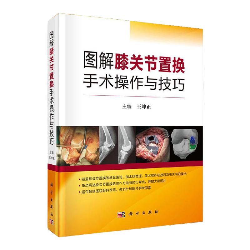领券立减 图解膝关节置换手术操作与技巧 膝关节外科领域 围术期管理手术操作技巧 技术在膝关节置换中应用手术图片3D打印技术