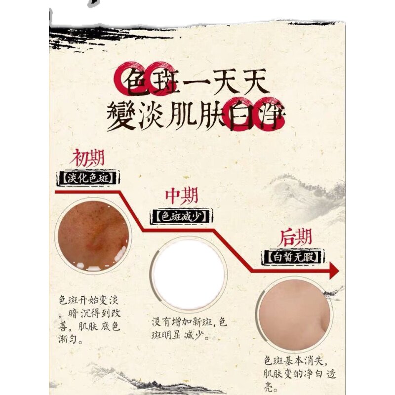 香港中华药宝强效祛斑霜早晚套装七天美白去斑王康雪斑点清扒皮霜