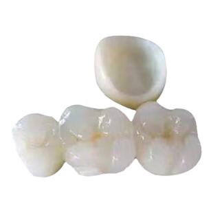 牙宜优品牌美国进口3M拉瓦二氧化锆全瓷牙冠假牙修复种植牙真品