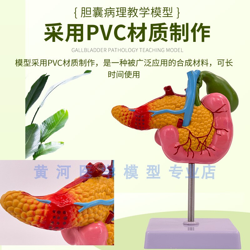 黄河胰腺十二指肠胆囊病理模型胆结实消化系统模型肝医学