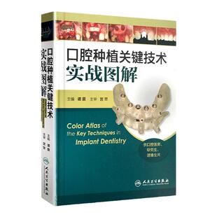口腔种植关键技术实战图解 精装 彩图版 主编 谭震 供口腔医师、研究生、进修生用书口腔种植医学书籍医师临床用书