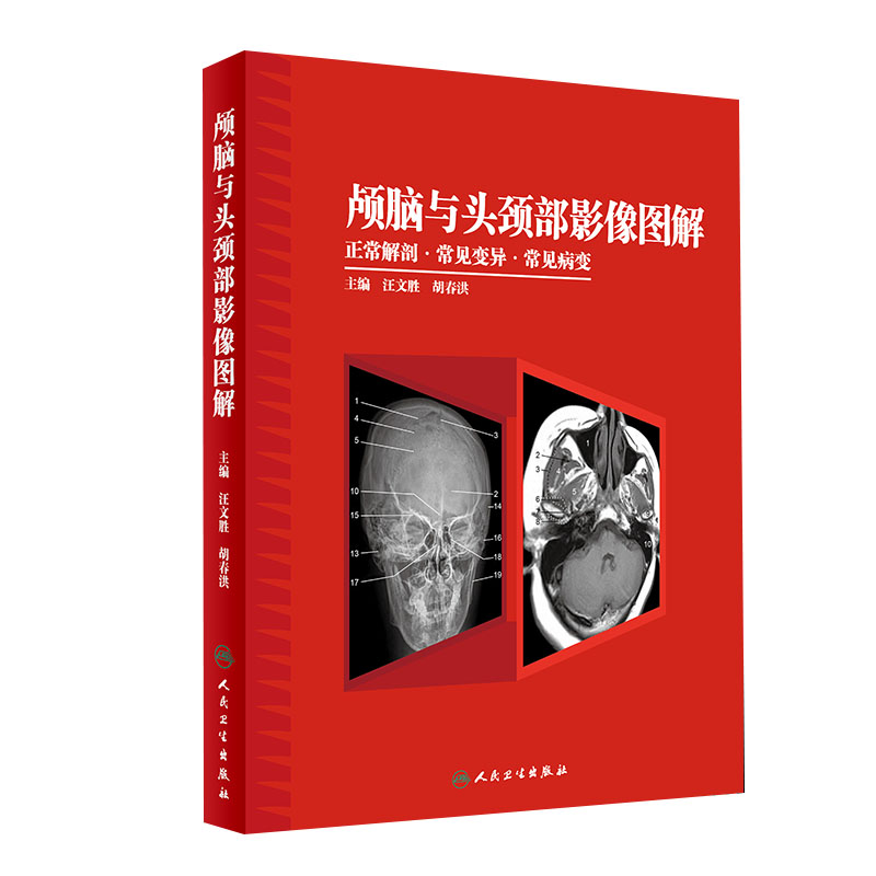 颅脑与头颈部影像图解正常解剖常见变异常见病变汪文胜 胡春红主编影像解剖与临床图解临床医学丛书影像实用书籍人民卫生出版社