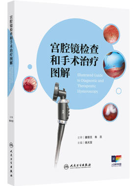 宫腔镜检查和手术治疗图解 徐大宝冷刀技术热刀置镜控镜妊娠并发症妇科疾病检查护理子宫内膜癌妇产科学人民卫生出版社妇科内镜学