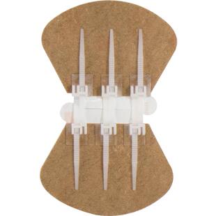 薛湖减张贴拉合型两片伤口减张器剖腹产术后疤痕抑制三排扣医用