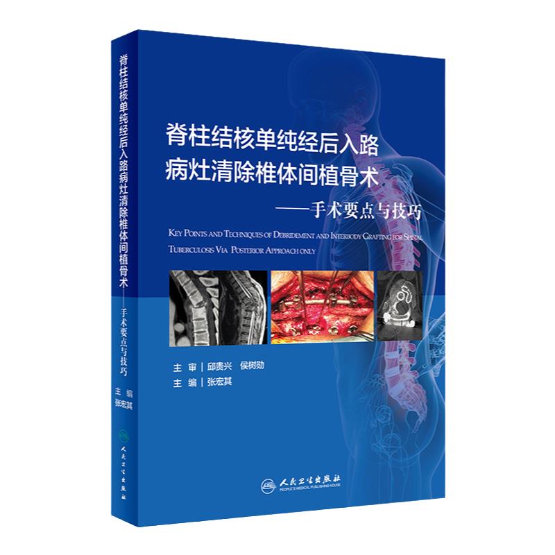 脊柱结核单纯经后入路病灶清除椎体间植骨术手术要点与技巧优化张宏其强直性脊柱炎外科学书籍治疗诊断手法实用骨科学整骨技术图谱
