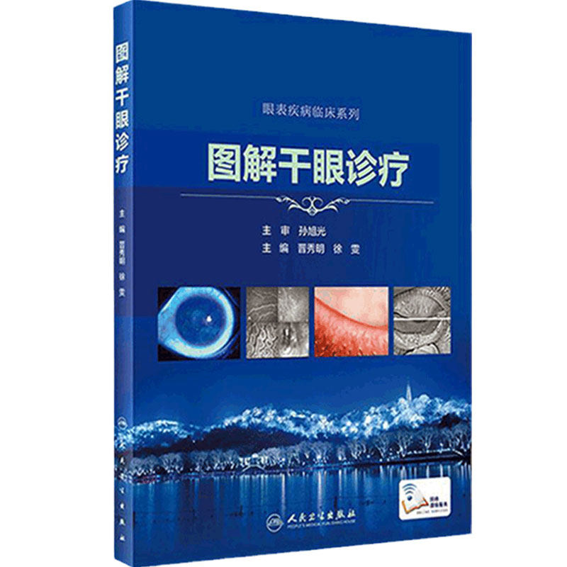 图解干眼诊疗 晋秀明徐雯主编 眼科学干眼症治疗干眼检查诊疗护理睑缘炎结膜角膜病变人民卫生出版社眼科书籍