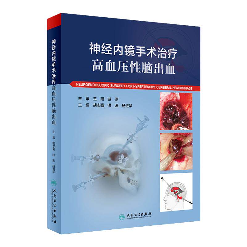 神经内镜手术治疗高血压性脑出血 人卫心脑血管高压氧治疗危急重症癫痫康复治疗临床神经病学系统人民卫生出版社实用内科学书籍