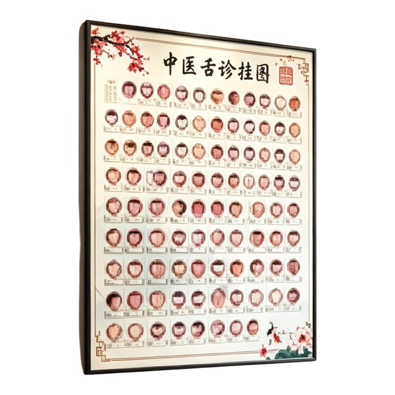 中医舌诊图谱大挂图70×100CM加厚相纸覆膜彩色高清文字大张海报