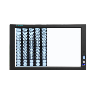 牙科医用观片灯箱LED超薄智能感应调光阅片灯骨科X光CT核磁看片灯