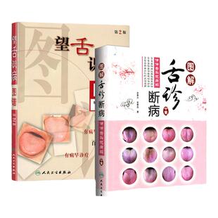 正版 中医舌诊套装2本 望舌识病图谱 第2版+图解舌诊断病 中医舌诊图解图谱 罗大伦 中医舌像舌苔舌象辨析 临床病症望舌诊病方剂