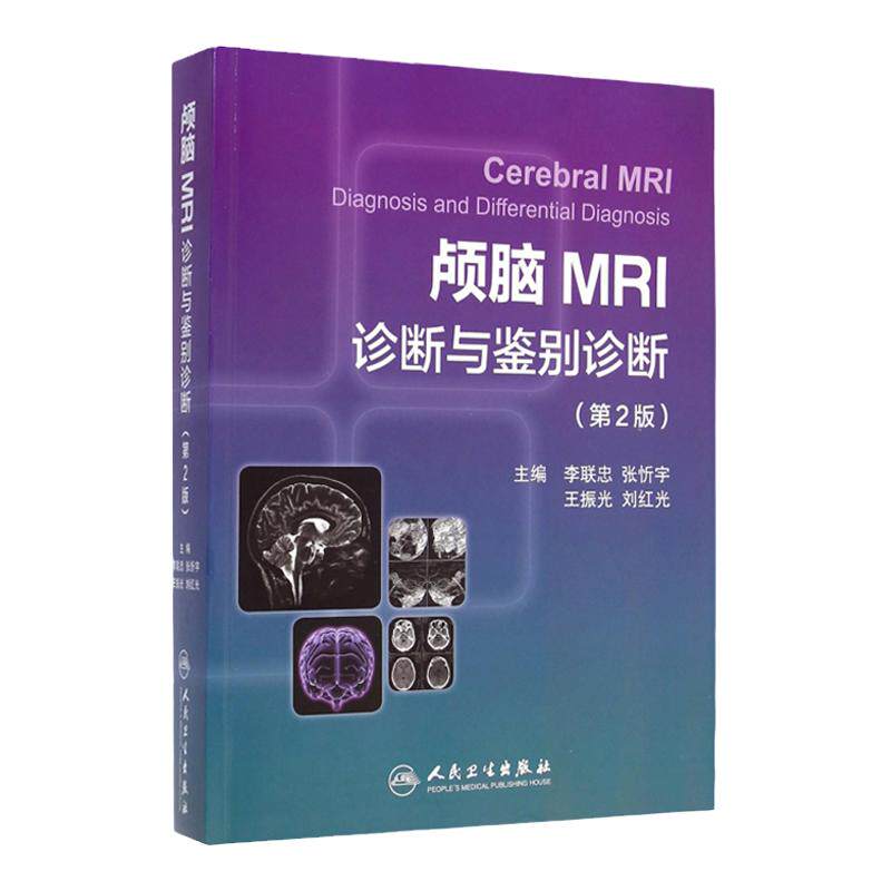 ZJ包邮正版 颅脑MRI诊断与鉴别诊断-(第2版) 李联忠 等 书店书籍图书 医学 临床医学理论 诊断学