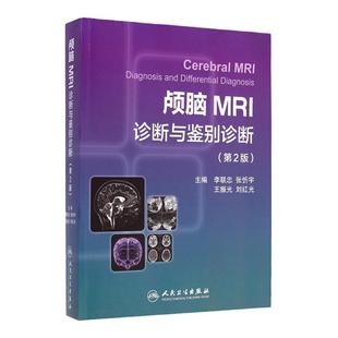 ZJ包邮正版 颅脑MRI诊断与鉴别诊断-(第2版) 李联忠 等 书店书籍图书 医学 临床医学理论 诊断学