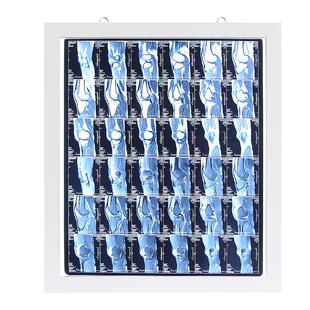 LED观片灯阅片灯三联看观片灯双联骨科牙科X光看片灯医用观片灯