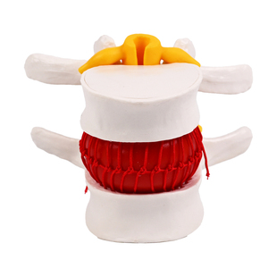 大腰椎带血球模型解剖结构清晰血管神经标注医用教学演示教具学习