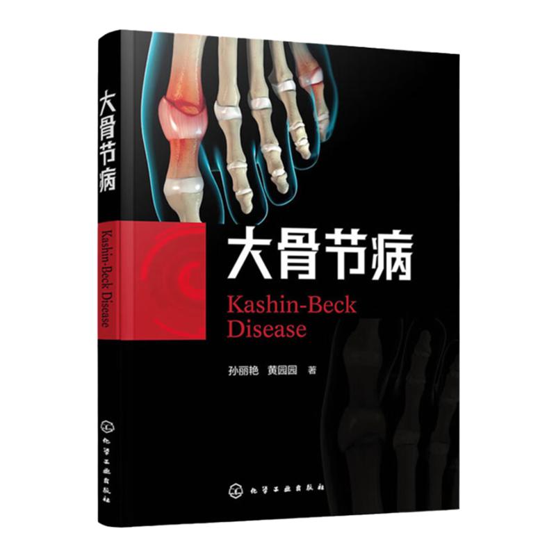 大骨节病 孙丽艳 黄园园 著 化学工业出版社9787122417572