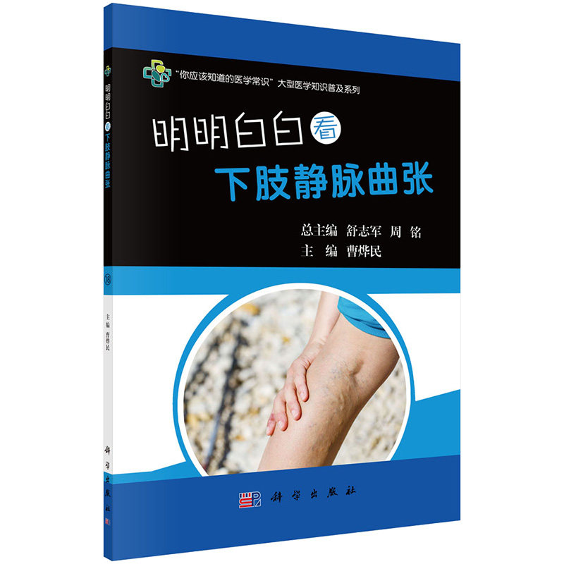 明明白白看下肢静脉曲张 你应该知道的医学常识大型医学知识普及系列 下肢静脉曲张知识 下肢静脉曲张检查与诊断治疗 科学出版社