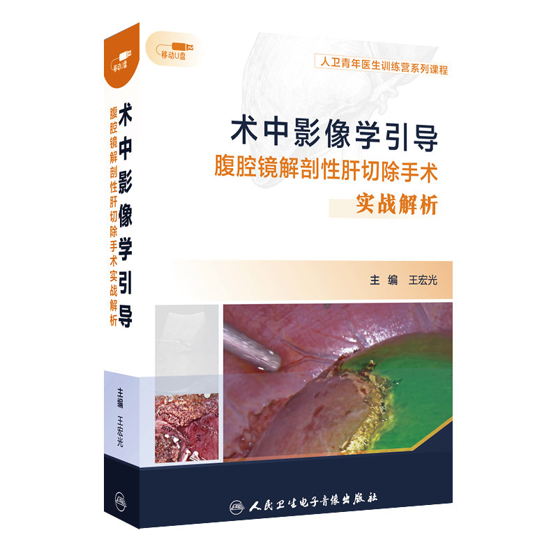 术中影像学引导腹腔镜解剖性肝切除手术实战解析王宏光视频课人民