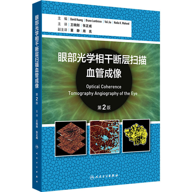 眼部光学相干断层扫描血管成像 第2版 王晓刚 张正威 主译 内容丰富贴合临床的实用性专业书籍 人民卫生出版社 9787117391023