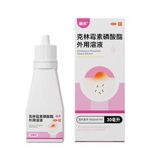 丽芙克林霉素磷酸酯外用溶液喷雾克林霉素磷酸溶液喷雾后背祛痘