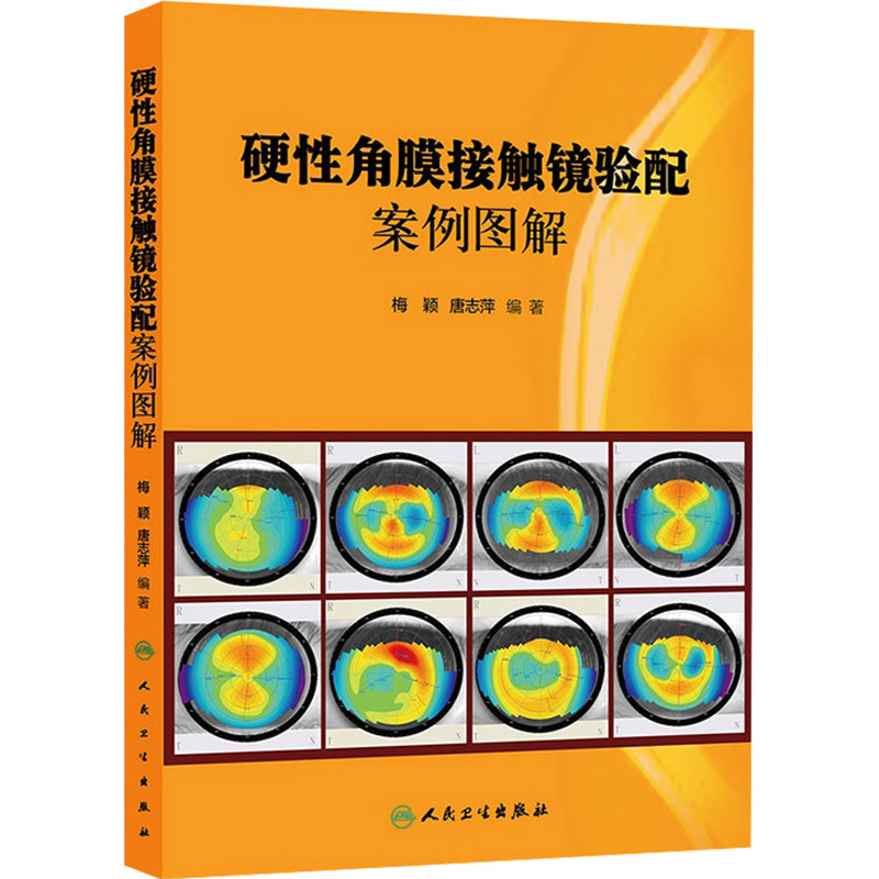人卫社 硬性角膜接触镜验配案例图解 梅颖 唐志萍 隐形眼镜球面设计RGP复曲面设计RGP复杂屈光不正RGP圆锥角膜角膜塑形验配案例书