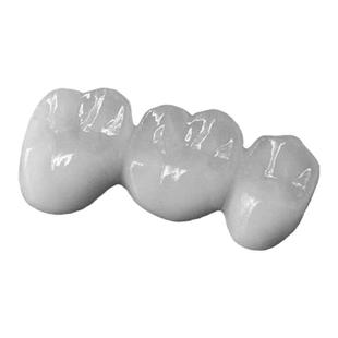 德国进口威兰德全瓷牙冠美国Lava烤瓷牙假牙种植定制爱尔创牙贴面